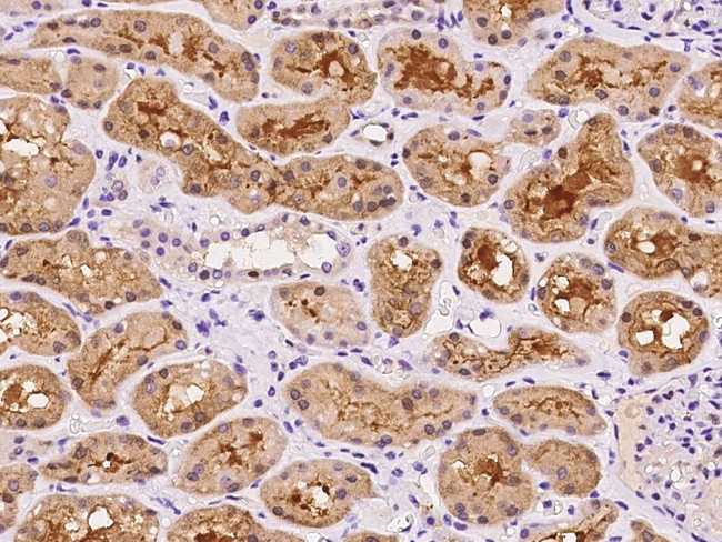 DPP3 Antibody in Immunohistochemistry (Paraffin) (IHC (P))