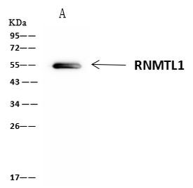 RNMTL1 Antibody in Immunoprecipitation (IP)