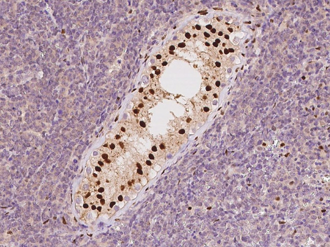 TCEAL3 Antibody in Immunohistochemistry (Paraffin) (IHC (P))