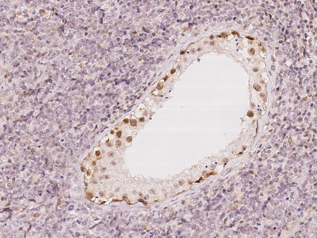 UBLCP1 Antibody in Immunohistochemistry (Paraffin) (IHC (P))