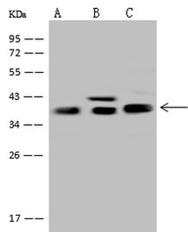 Aldolase C Antibody in Western Blot (WB)