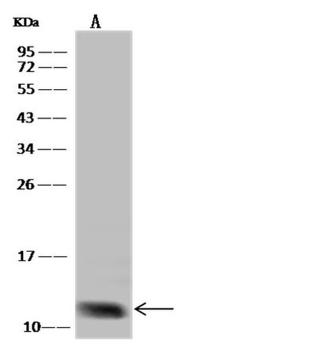 CXCL5 Antibody in Western Blot (WB)