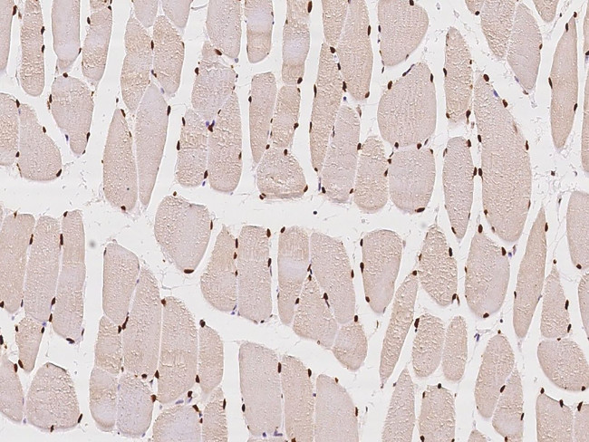 CUTC Antibody in Immunohistochemistry (Paraffin) (IHC (P))
