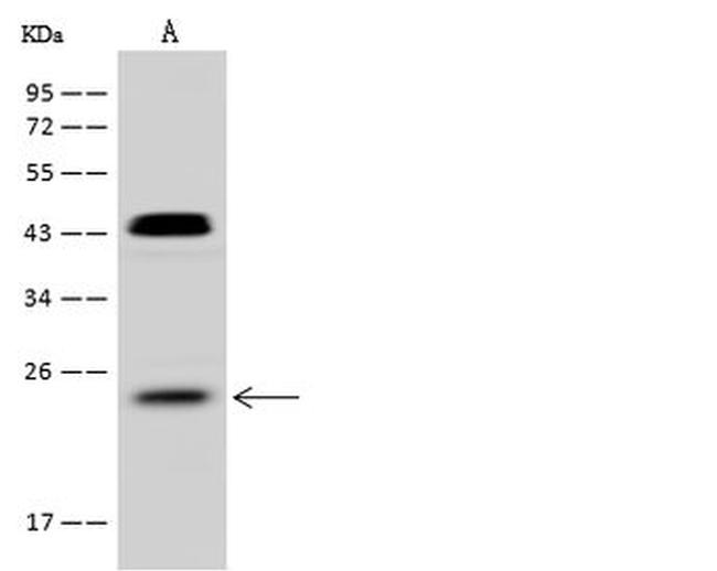 RhoF Antibody in Western Blot (WB)
