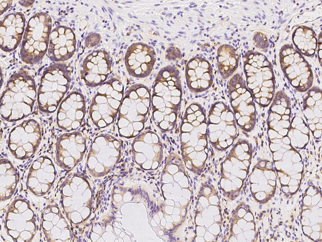 RPL14 Antibody in Immunohistochemistry (Paraffin) (IHC (P))