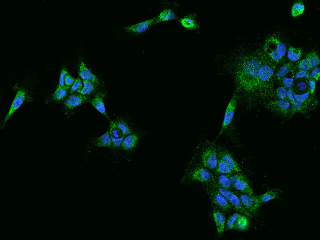 PECR Antibody in Immunocytochemistry (ICC/IF)
