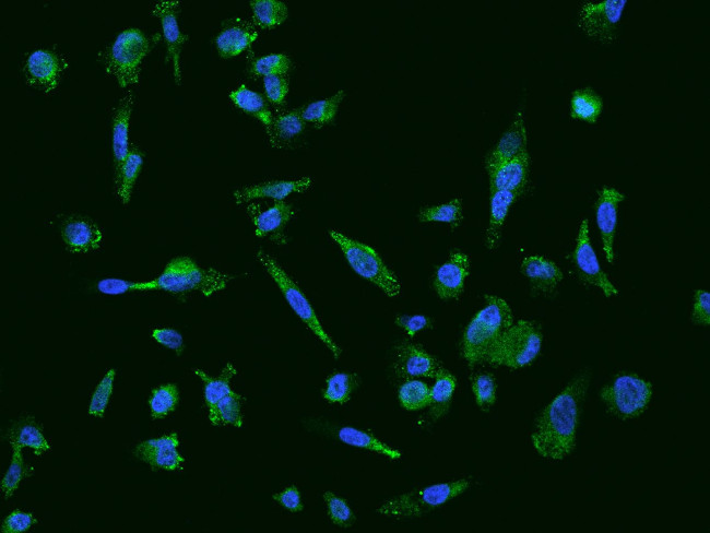 TPK1 Antibody in Immunocytochemistry (ICC/IF)