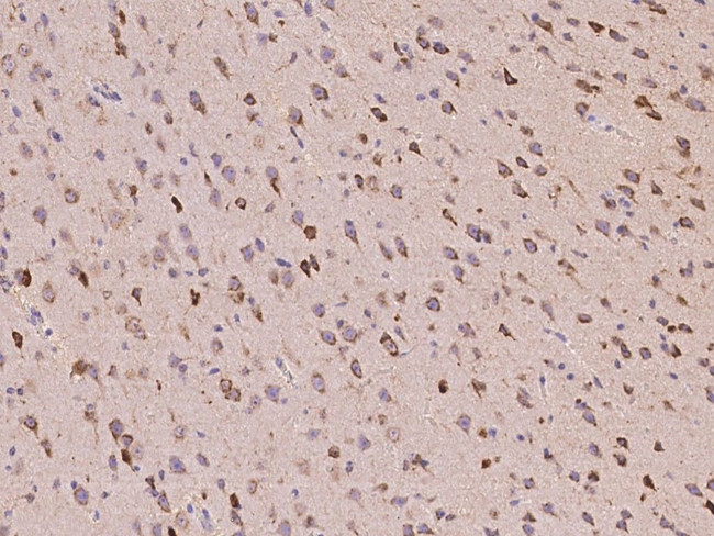 Neuroserpin Antibody in Immunohistochemistry (Paraffin) (IHC (P))