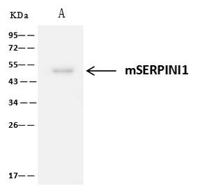 Neuroserpin Antibody in Immunoprecipitation (IP)