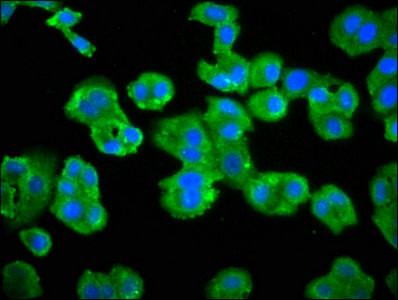 GRK3 Antibody in Immunocytochemistry (ICC/IF)