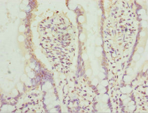 AGPAT2 Antibody in Immunohistochemistry (Paraffin) (IHC (P))