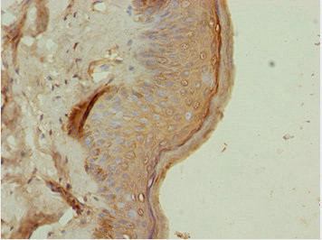 ATMIN Antibody in Immunohistochemistry (Paraffin) (IHC (P))