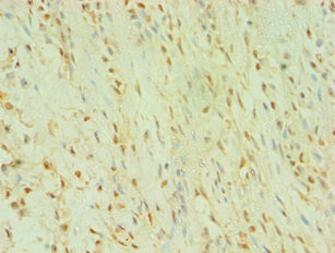 BLK Antibody in Immunohistochemistry (Paraffin) (IHC (P))