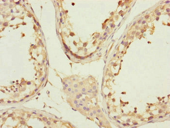 CCHCR1 Antibody in Immunohistochemistry (Paraffin) (IHC (P))