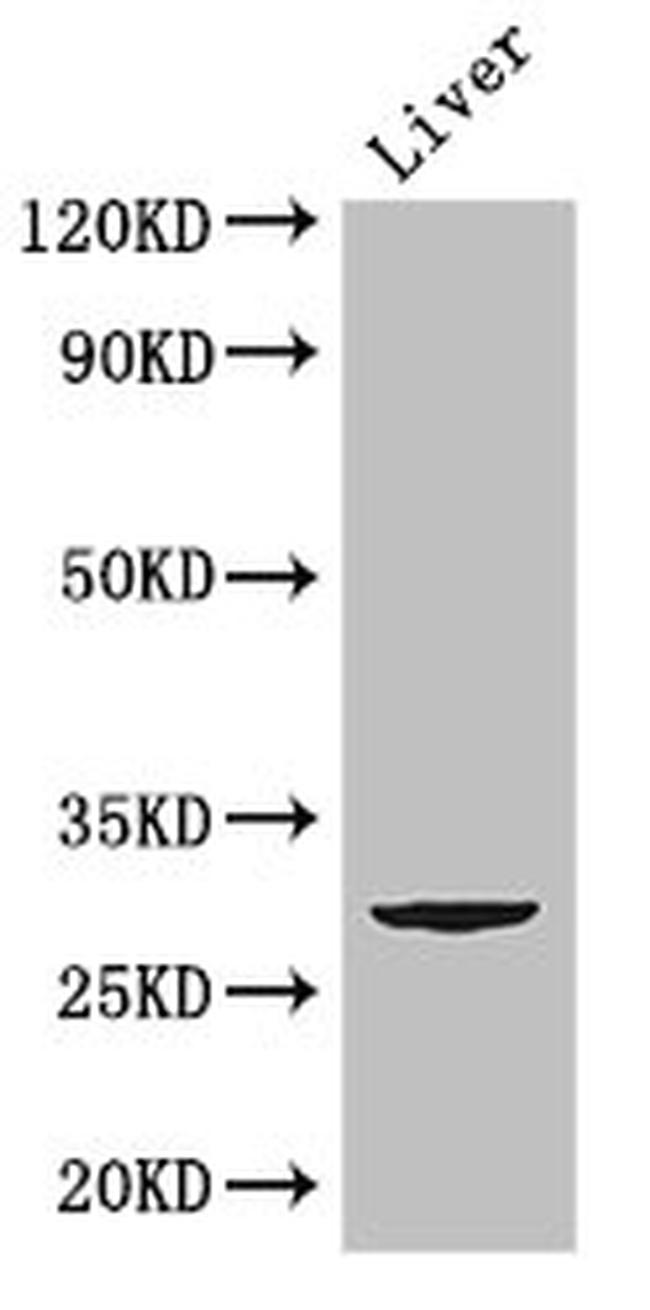 CD151 Antibody in Western Blot (WB)