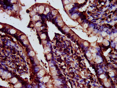 CDR2L Antibody in Immunohistochemistry (Paraffin) (IHC (P))