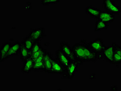 CDX1 Antibody in Immunocytochemistry (ICC/IF)