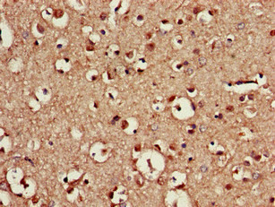 CDX4 Antibody in Immunohistochemistry (Paraffin) (IHC (P))