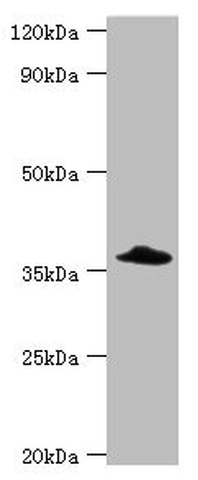 CFHR3 Antibody in Western Blot (WB)