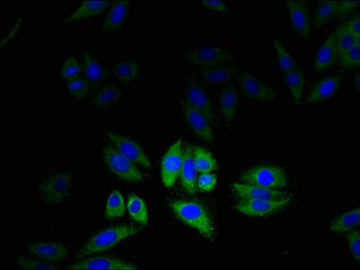 CLIC2 Antibody in Immunocytochemistry (ICC/IF)