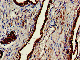 ENTH Antibody in Immunohistochemistry (Paraffin) (IHC (P))