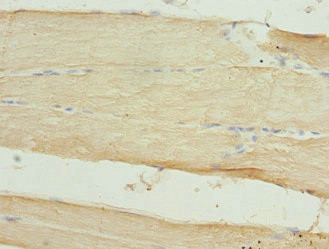 CLK1 Antibody in Immunohistochemistry (Paraffin) (IHC (P))