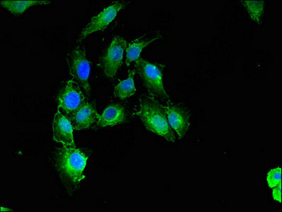 Calponin 3 Antibody in Immunocytochemistry (ICC/IF)