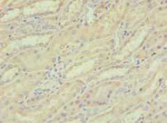 LZIP Antibody in Immunohistochemistry (Paraffin) (IHC (P))