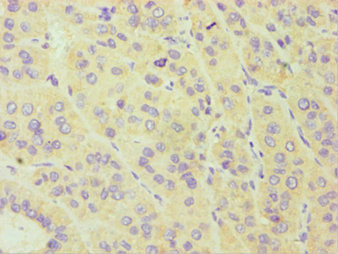 CYP3A5 Antibody in Immunohistochemistry (Paraffin) (IHC (P))