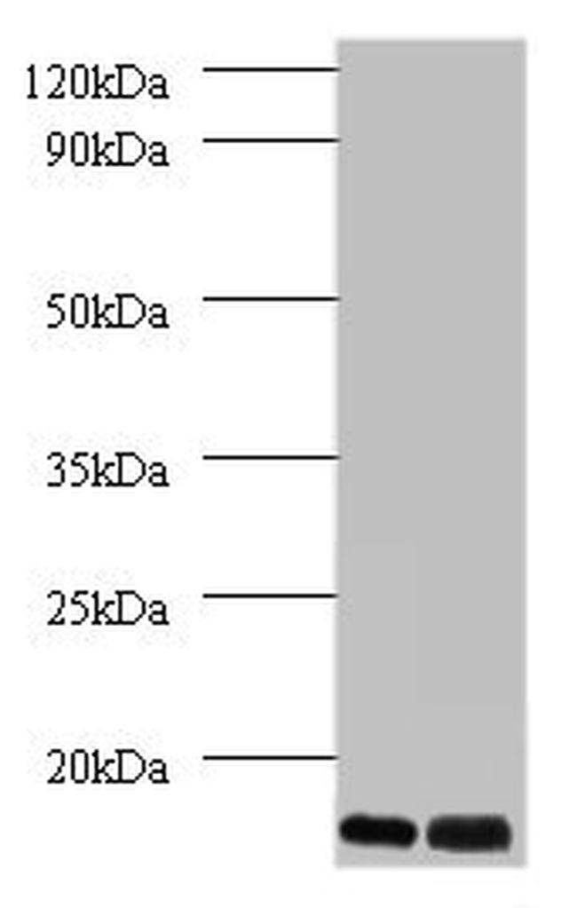 MP68 Antibody in Western Blot (WB)