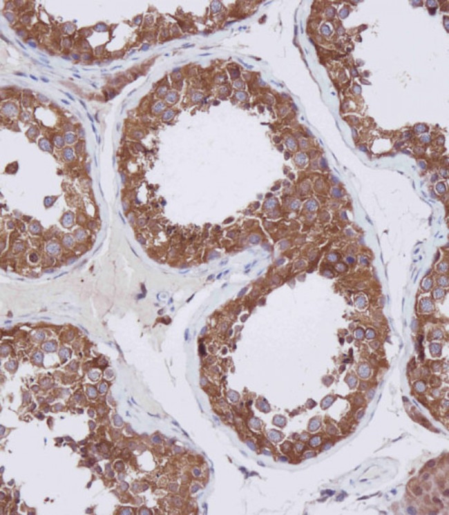 HDAC6 Antibody in Immunohistochemistry (Paraffin) (IHC (P))
