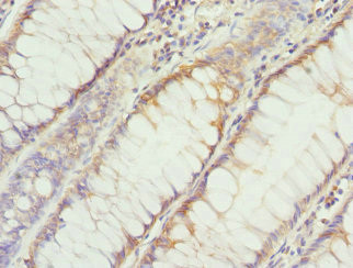 DHDDS Antibody in Immunohistochemistry (Paraffin) (IHC (P))