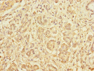 DIAPH2 Antibody in Immunohistochemistry (Paraffin) (IHC (P))