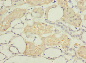 DPYS Antibody in Immunohistochemistry (Paraffin) (IHC (P))