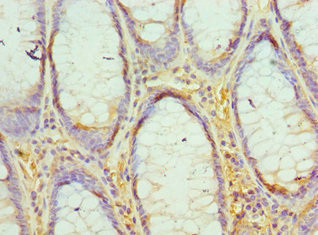 EED Antibody in Immunohistochemistry (Paraffin) (IHC (P))
