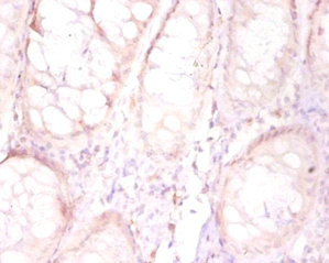FAM110B Antibody in Immunohistochemistry (Paraffin) (IHC (P))