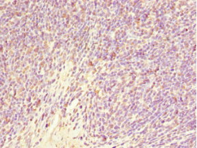 GABRR1 Antibody in Immunohistochemistry (Paraffin) (IHC (P))