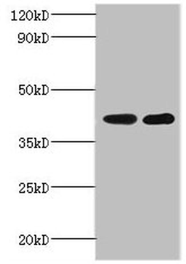 GLT8D2 Antibody in Western Blot (WB)