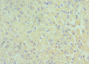 GluD2 Antibody in Immunohistochemistry (Paraffin) (IHC (P))