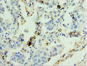 GSTA4 Antibody in Immunohistochemistry (Paraffin) (IHC (P))