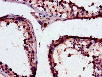 GSTM3 Antibody in Immunohistochemistry (Paraffin) (IHC (P))