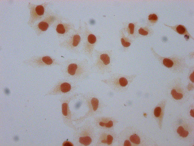 Mono-Methyl-Histone 1F0 (Lys101) Antibody in Immunocytochemistry (ICC/IF)