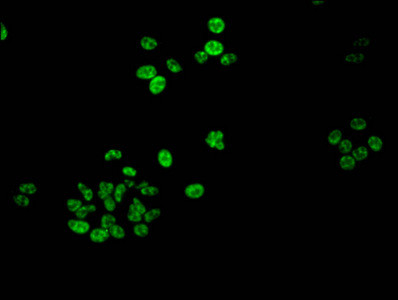Phospho-Histone H1.5 (Ser188) Antibody in Immunocytochemistry (ICC/IF)