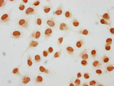 2-hydroxyisobutyryl-Histone H1.2 (Lys109) Antibody in Immunocytochemistry (ICC/IF)