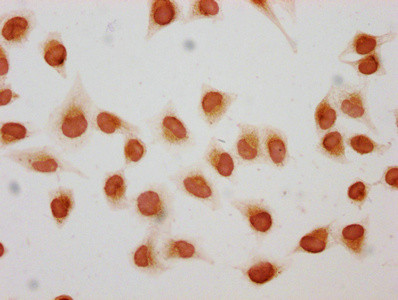 2-hydroxyisobutyryl-Histone H1.2 (Lys158) Antibody in Immunocytochemistry (ICC/IF)