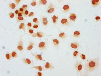 Mono-Methyl-Histone H1.2 (Lys45) Antibody in Immunocytochemistry (ICC/IF)