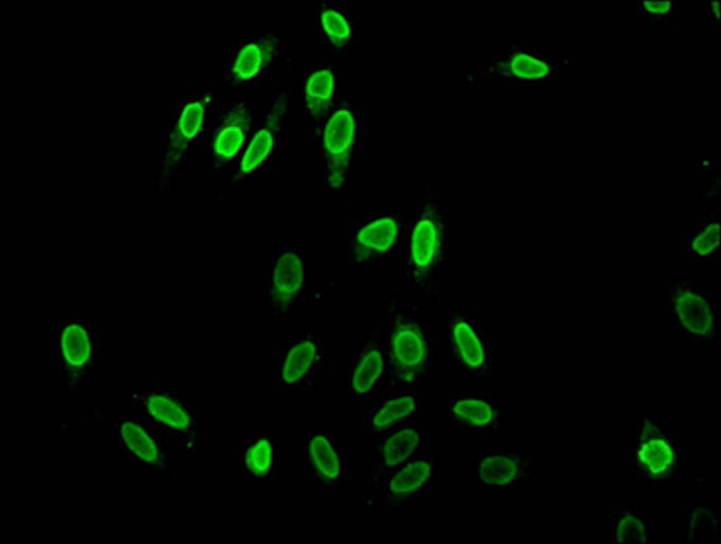 Acetyl-Histone H1.2 (Lys96) Antibody in Immunocytochemistry (ICC/IF)