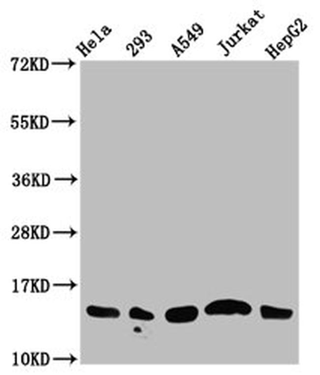 Acetyl-Histone Macro-H2A.1 (Lys13) Antibody in Western Blot (WB)