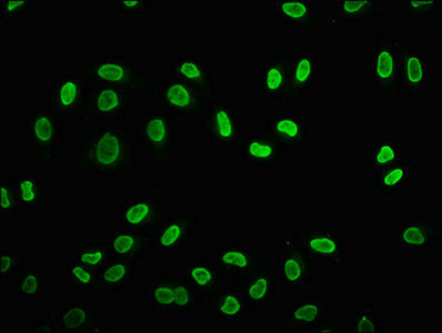 Butyryl-Histone H2B (Lys5) Antibody in Immunocytochemistry (ICC/IF)