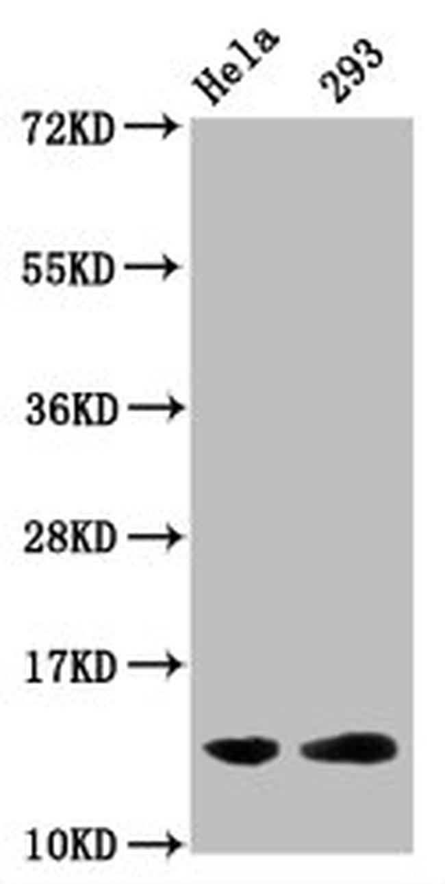 Glutaryl-Histone H2B (Lys5) Antibody in Western Blot (WB)